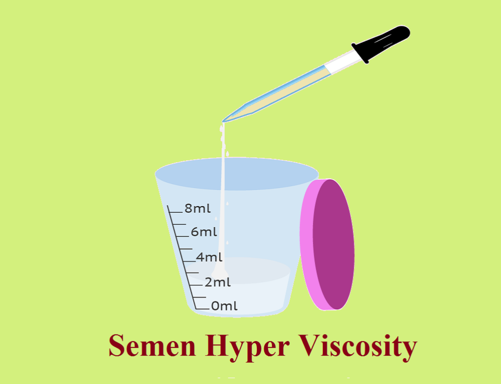 SHV - Semen Hyper Viscosity