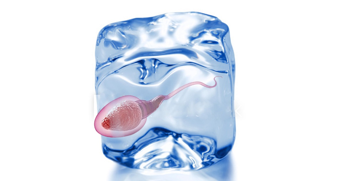 Cryo-survival of Sperm